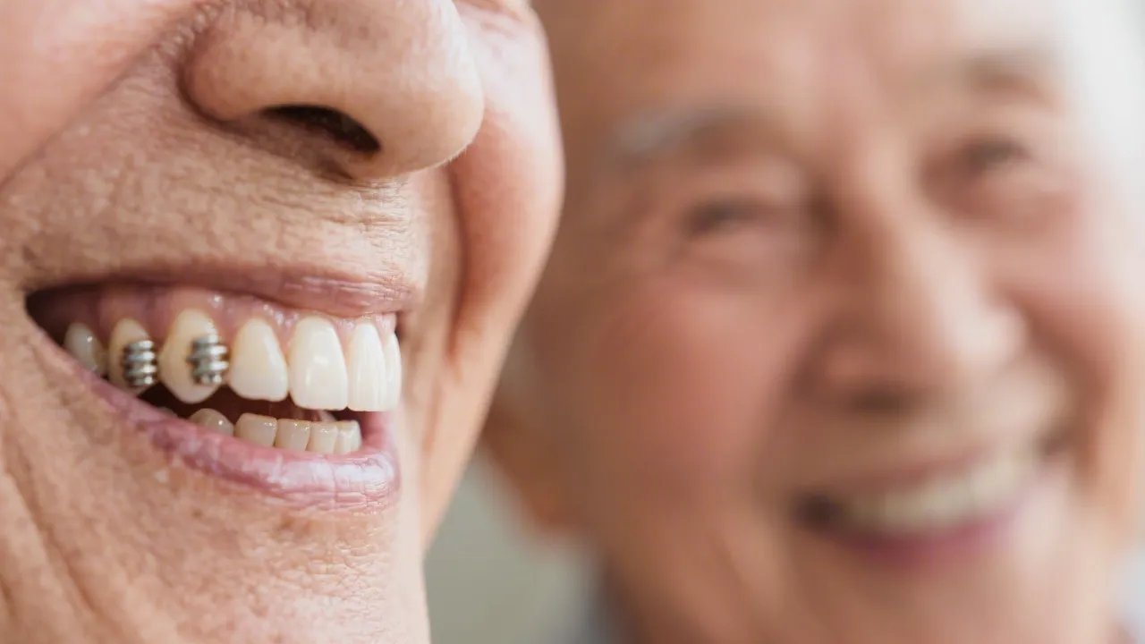Navigating Dental Implants for Seniors