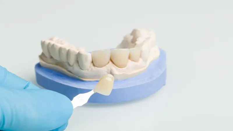 Cost-Effective Tooth Replacement Options: A Complete Guide